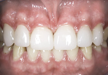 fasete zubi 03 ispravljeni