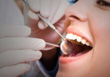 lečenje kanala zuba
