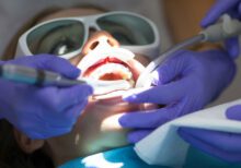 primena lasera dental centar